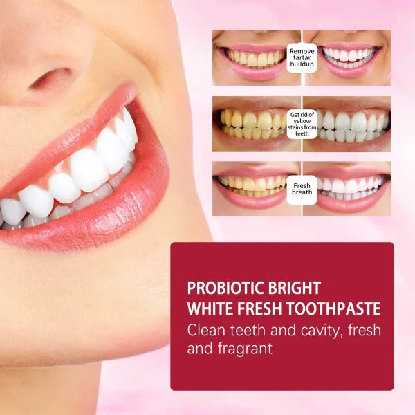Original SP-4 Ultra+ Probiotic Whitening Toothpaste